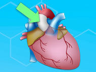 Patient Q&A: Can Aorta Grafts Calcify After Heart Valve Surgery?