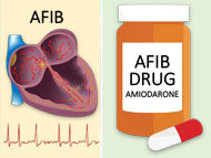 Doctor Q&A: Atrial Fibrillation & Amiodarone After Heart Surgery