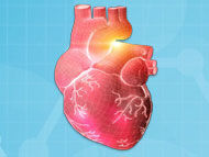 Restarting the Heart After Cardiac Surgery