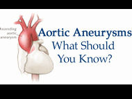 Critical Insights About Aortic Aneurysms & Heart Valve Disease with Dr. Eric Roselli