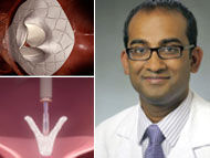 Mitral Valve Clinical Trials: Surgeon Insights with Dr. Pavan Atluri