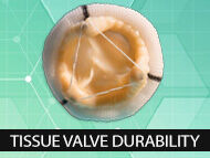 Research Update: Tissue Valve Replacement Durability for Young Patients