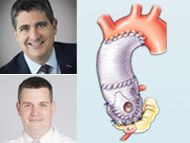 Surgeon Roundtable: Advantages of Valve-Sparing Aortic Root Replacement