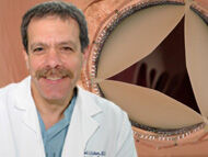 Surgeon Q&A: The Future of Heart Valve Surgery with Dr. Michael Acker