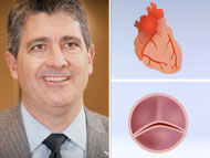 New Surgical Innovations: Bicuspid Aortic Valve & Aortic Aneurysms with Dr. Eric Roselli