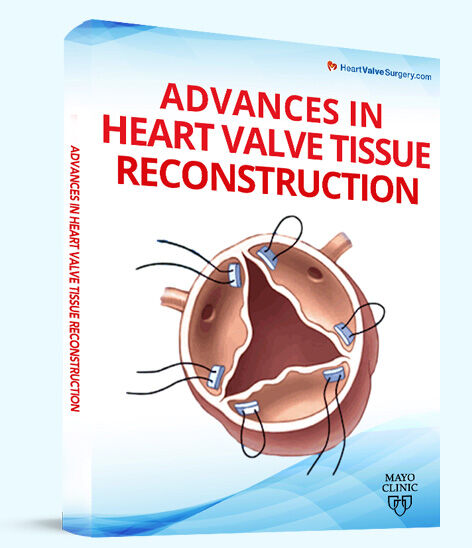 Patient eBook: Advances in Heart Valve Tissue Reconstruction