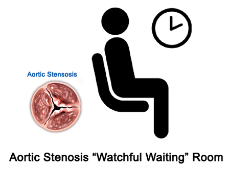 Aortic Stenosis Watchful Waiting
