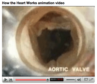 Four Heart Valves Videos - Click To Watch