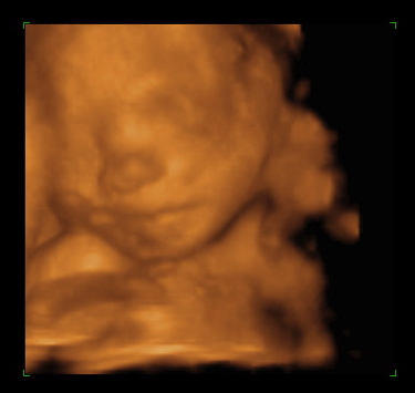 Baby Imaging on 4d Pictures Baby Womb  Images Photos