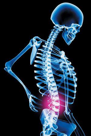 Back Pain And Mitral Valve