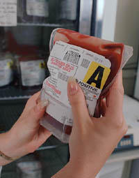 Blood Bank Before Heart Valve Surgery Blood Bank Before Heart Valve Surgery