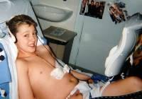 Jack Burd Has Keyhole Heart Valve Replacement