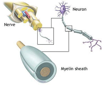 Nerve Damage After Heart Surgery -- Patient Discussion