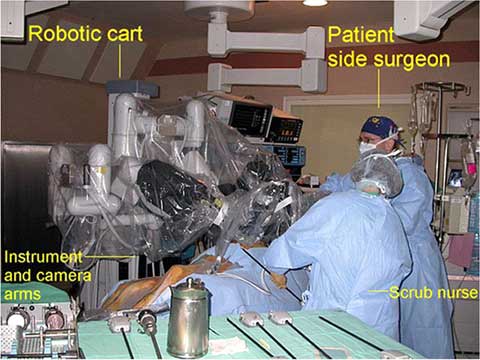 Robotic Surgery Operating Room - Mitral Valve Repair