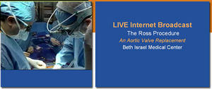 Open Heart Surgery Video