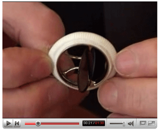 Video - How Tissue And Mechanical Heart Valve Relacements Are Sutured (Stitched) Into The Heart