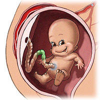 Stem Cells To Form Heart Valves From Baby Umbilical Cord