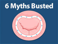 Surgeon Roundtable: 6 Mitral Valve Surgery Myths