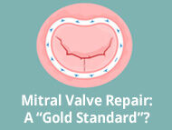 Mitral Valve Repair: The 