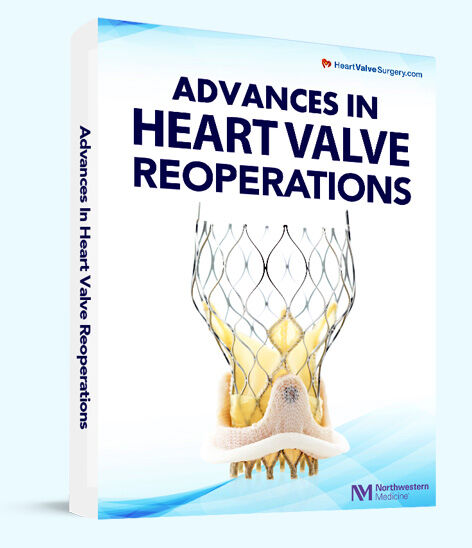 Advances In Heart Valve