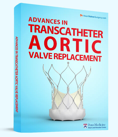 Patient eBook: Advances in Transcatheter Aortic Valve Replacement
