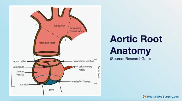 aortic root anatomy