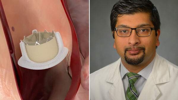 Heart Valve Re-Operations: What Should Patients Know?
