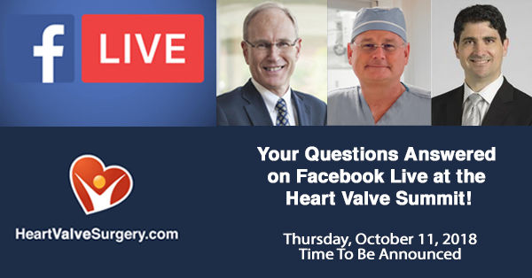 Invitation to participate in Ask Adam Anything event on Facebook Live