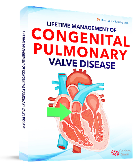 Lifetime Management of Congenital Pulmonary Valve Disease eBook