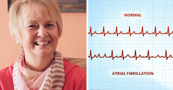 Linda, patient, next to atrial fibrillation heart rhythm