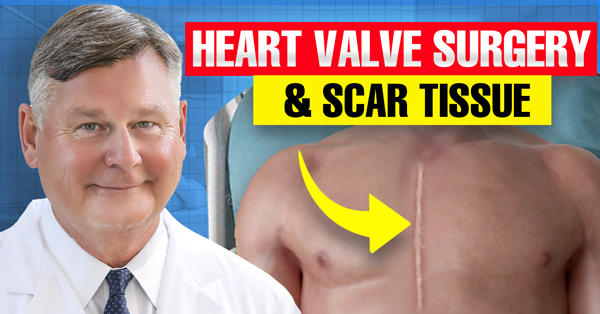 Surgeon Q&A: Scar Tissue and Minimally Invasive Heart Valve Reoperations