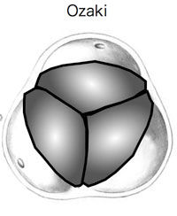 Ozaki procedure