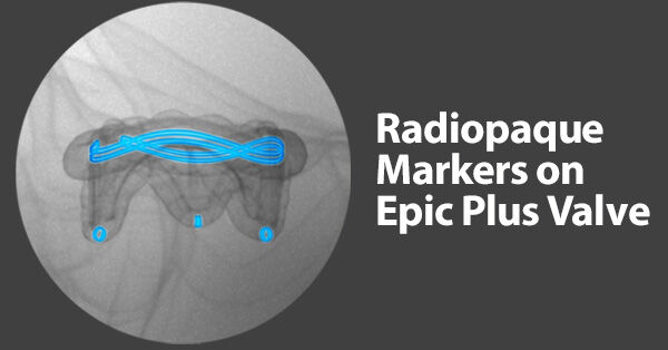 Radiopaque Markers on Heart Valve Replacement Device