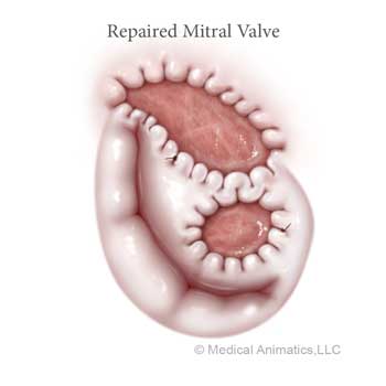 Extracellular Matrix On Mitral Valve