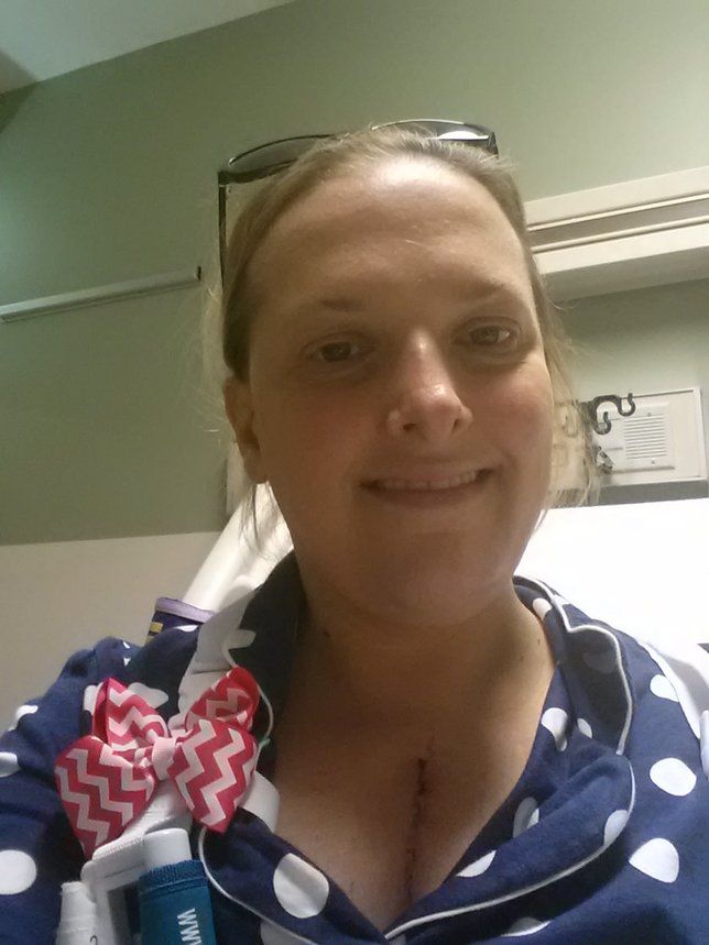Cris Dykeman, heart valve patient, showing incision