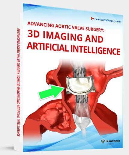 Advancing Aortic Valve Surgery Using 3D Imaging & Artificial Intelligence