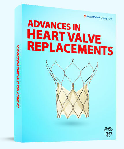 Patient eBook: Advances in Heart Valve Replacements