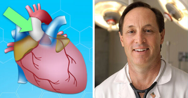 Dacron Grafts After Aortic Valve Surgery with Dr. Kevin Accola