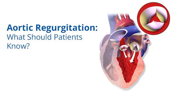 Aortic Regurgitation What Should Patients Know?