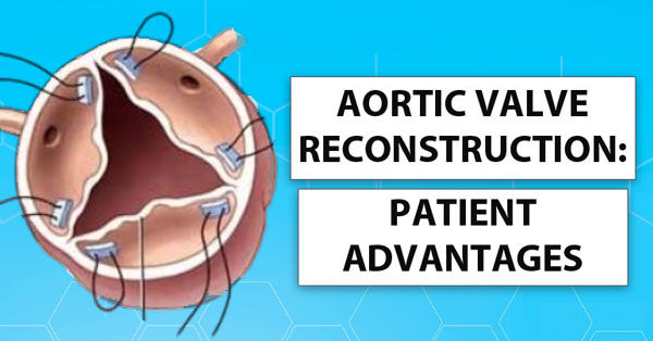 Aortic Valve Reconstruction Patient Advantages