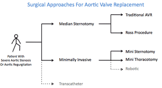 Surgical Approaches For Aortic Valve Replacement Surgery