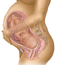 Child Birth (Natural or C-Section) for Patients with Valve Disease