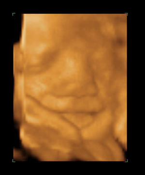 Baby Pick - 29 Weeks Baby Pick - 29 Weeks