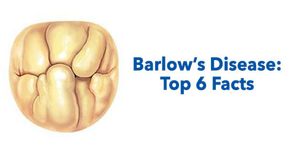 Barlow's Heart Valve Disease