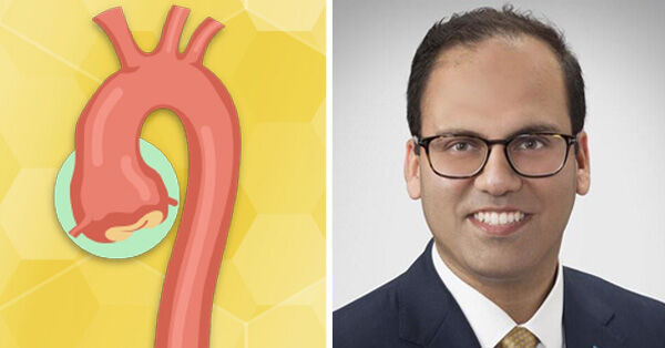 Aneurysm, Bicuspid Aortic Valve & Dr. Ibrahim Sultan