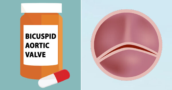 Bicuspid Aortic Valve Medications