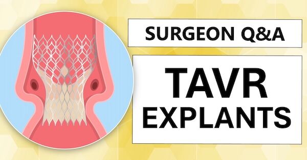 TAVR Explants & The Lifetime Management of Aortic Stenosis