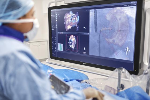 Transcatheter Heart Valve Imaging