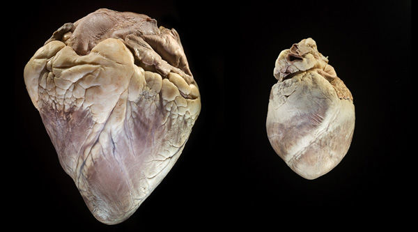 Cow and Human Heart Comparison
