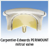 Edwards Lifesciences Mitral Valve